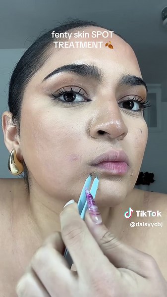 FENTY Skin Spot Treatment | Pimple Patch Removal