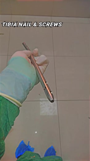 Name : Tibia Nail Cortical Screws . . . . . Short Intro : The Tibial (Tibia) Nail System is a specialized orthopedic implant designed for the internal stabilization of fractures along the tibia shaft, including proximal and distal segment fractures, as well as complex, multi-fragmentary, or open injuries. These nails are typically crafted from titanium alloy or stainless steel and are inserted into the medullary canal to provide a load-sharing, stable construct that facilitates early mobilizatio