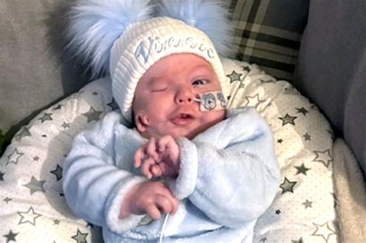Baby Born with ‘Ear on His Right Cheek,' Leaving His Parents Shocked and Confused: 'No Preparation for It'