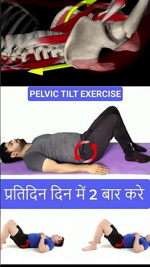✅Pelvic tilt exercise for Disc Herniation treatment #Drsuniltank #physiopoint