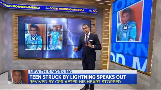 Teen feels like Superman after surviving lightning strike