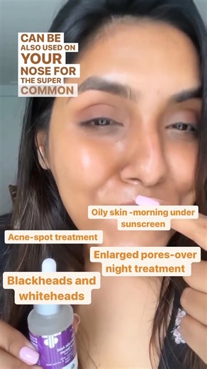 5.4M views · 1.2K reactions | Struggling with active acne? Try our bestselling 2% Salicylic Acid Serum. It controls excess oil, prevents breakouts & keeps your skin clear. Shop now! Use code: REDEEM35. | The Derma Co. | Facebook
