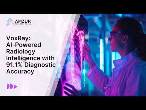 VoxRay: AI Powered Radiology Intelligence with 91.1% Diagnostic Accuracy