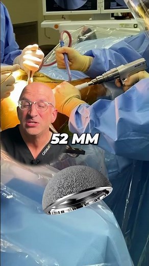 How Does a Hip Replacement Stay In Place? 🔨 Pressfit Hip Implants #shorts