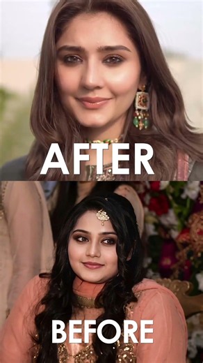 Durefishan Saleem Before vs After Plastic Surgery? | Pakistani Celebrity Transformation