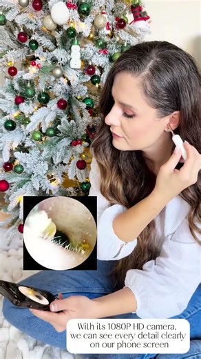 Bebird Earsight Complete Ear Wax Removal Tool - It’s comfortable, clear, and worry-free!