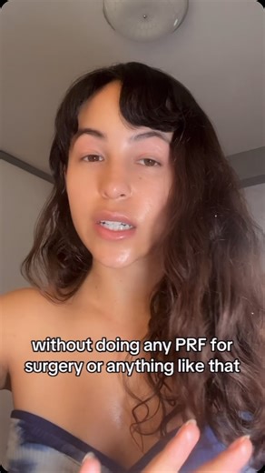 Elsa on Instagram: "How to get rid of under eye indentation 💖"