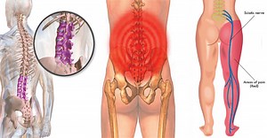 Try These 9 Stretches for Lower Back Pain and Sciatica Pain Relief