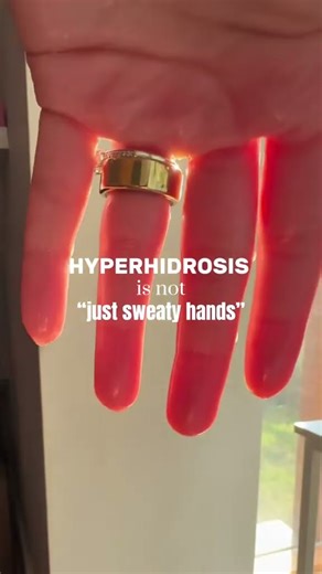 Hyperhidrosis is a medical condition that causes excessive sweating #hyperhidrosis