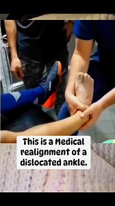 Medical realignment of the foot or ankle, also known as a closed reduction, is a procedure where your bones are manually put back into their proper positions after a break or dislocation. A medical realignment can be performed if you have a closed break the bone does not puncture through the skin. ✅ | Veronica's blog