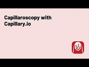 Tutorial: How to perform Capillaroscopy with Capillary.io