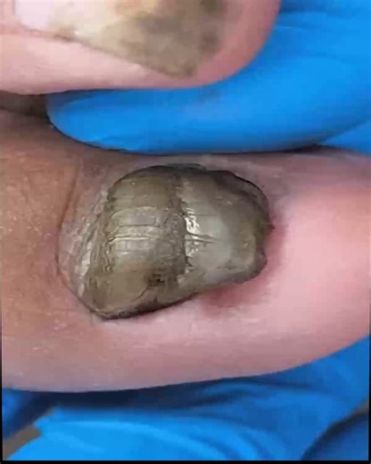 Trusted Methods to Improve Dry Cuticles That Prevent Future Issues #HealthyNails #NailCareTips #SimpleNailCare #ToenailRoutine | NC State Wolfpack on TheWolfpacker.com