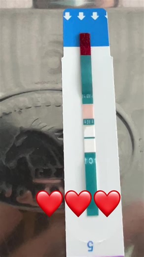 Alere combo độ chính xác cao. Cho ai có nguy cơ 21 ngày. #hiv #benhxahoi