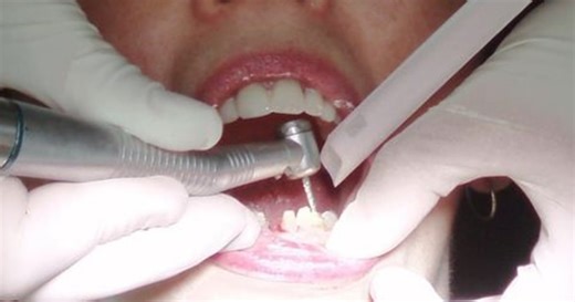 Dental costs still keeping people from the dentist