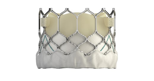 Did Edwards’ TAVR Platform Have Good Long-Term Results?