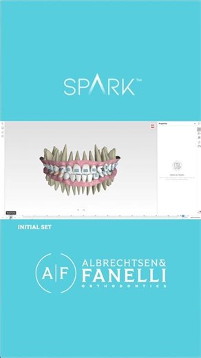 Clear Aligner Teeth Movement | Utah Orthodontist | Deep Bite | Invisalign