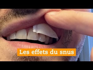 Les effets du snus sur la santé