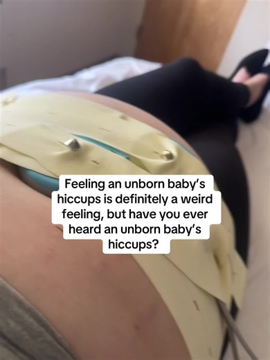Understanding Unborn Baby Hiccups During Pregnancy