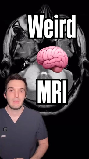 Medicine, Health, & Radiology on Instagram: "Don’t chase the 🐉 #brain #neuroscience #doctor #radiology #medicine"