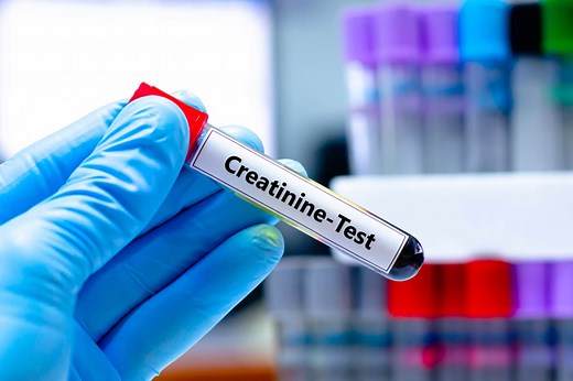 Créatinine (urinaire) : basse, élevée, quand s'inquiéter ?