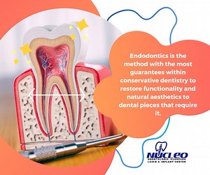 #Endodontics, eliminates pain, inflammation, and infection in #teeth with deep #cavities, fractures, or trauma. Let us help you today! . 📱Toll-Free: 1 855 988 4200. Phone: 915 308 0101 México: 656 625 9250 nucleodental.com . #NucleoDental #ElPasoTx🇺🇸 #CiudadJuarez🇲🇽 #NewMexico #dentalclinicnearme #oralcare #oralhealth | Nucleo Dental