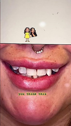 Can Your Smile Be Improved ? Braces ? Or Don't Do It? #smile #beauty #life