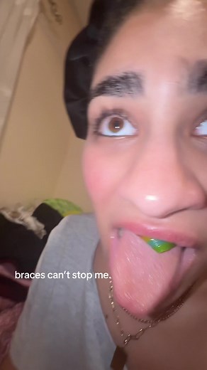 Flavored Rubber Bands for Braces: My Journey Begins