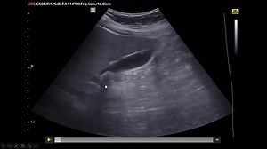 13K views · 298 reactions | Remember this simple trick while managing...