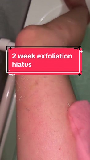 2 Week Exfoliation Hiatus Experience | Gross & Stevens Reviews