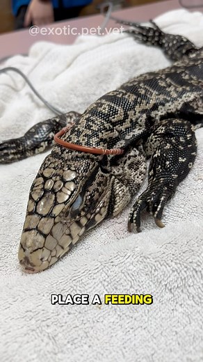 4.1K views · 75 reactions | How To Place an Esophageal Feeding Tube...