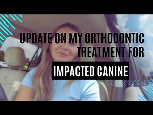 Update on my Orthodontic Treatment for Impacted Canine - Now and Before