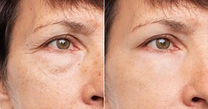 "Mon contour de l'œil est défroissé" grâce à ce sérum anti-âge qui lisse rides, cernes et poches (excellent sur Beauté Test)