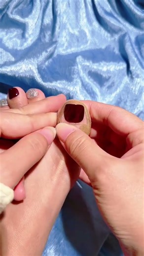 #How to fix ingrown toenails#Ingrown toenail pad#Ingrown toenail#Product sharing