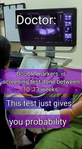 415K views · 27 reactions | Double marker is a blood test done between 11-14 weeks of gestation. THIS Test rule out chromosomal anomalies such as Down syndrome, this is only a screening test, and just give probabilities, One should go for Amniocentesis to confirm Down syndrome. #downsyndromeawareness #downsyndrome #chromosomal #chromosomalabnormality #doublemarker #doublemarkertest | Dr home - Dr shikha Agarwal | Facebook