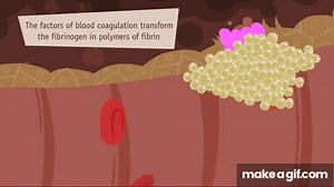 Hemostasis, Coagulation and Fibrinolisis on Make a GIF