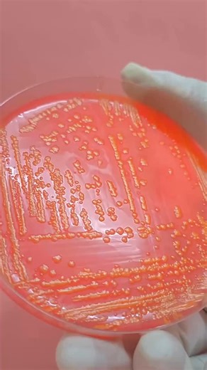 Hektoen enteric agar, is examined for typical colonial morphology after incubation. Fermentation of lactose, sucrose or salicin results in the production of acid which give rise to yellow-orange to salmon colored colonies. The orange haze around the colonies is due to the precipitation of the bile salts by the organism. Escherichia coli and other lactose ferments will produce yellow or orange colonies. Nonlactose fermenters including Shigella produce green colonies while Salmonella appears as bl