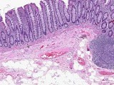 Colon - Histology • Video • MEDtube.net