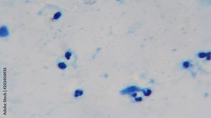 AFP stain show Microbacterium tuberculosis (TB) Deep focus , shoot by DSLR under microscope 1000x