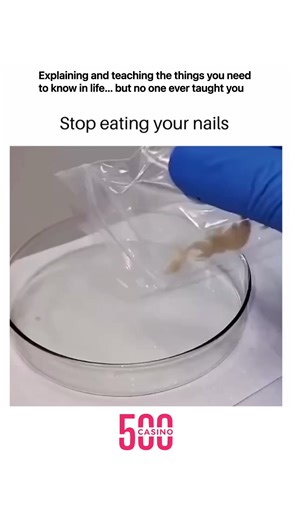 Teaching Real Life Skills on Instagram: "It’s a habit nobody admits to, but everyone secretly struggles with—nail biting! This reel nails (pun intended) the awkward, funny, and sometimes stressful moments that come with the urge to snack on your nails. From the moments when you catch yourself mid-bite, to the regret afterward seeing your fingertips, it’s a real struggle many can relate to. The reel gives a lighthearted reminder: stop the cycle before it’s too late for your nails—and your fingers