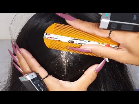 Ultimate ASMR Scalp Scratching 💅 | Long Hair + Flaky Dandruff Removal #028