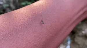 Aedes Mosquito Bites Human Arm Piercing Stock Footage Video (100% Royalty-free) 3832583477 | Shutterstock