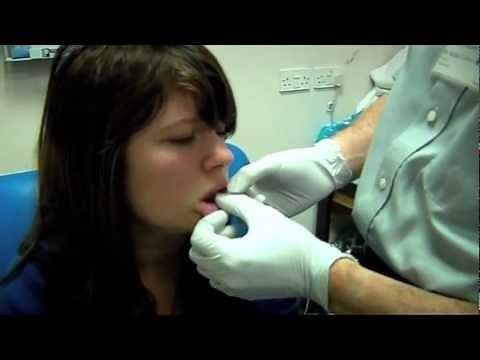 Lip Piercing Trauma (Part 1) - Bizarre ER
