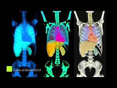 Clara: Enhancing Radiology with Cinematic Rendering