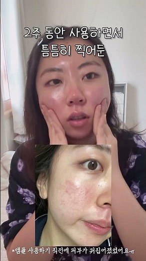 🍋넘버즈인 5번 앰플 글루타치온씨 흔적 앰플 2주 실제 사용 후기!✨ | 넘버즈인 글루타치온C 흔적 앰플 체험단 | #올리브영 #앰플 #앰플추천 #넘버즈인 #미백관리 #흔적 🍋