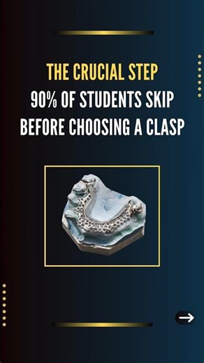 The crucial step 90% of students skip before choosing a clasp | Removable Partial Dentures #shorts