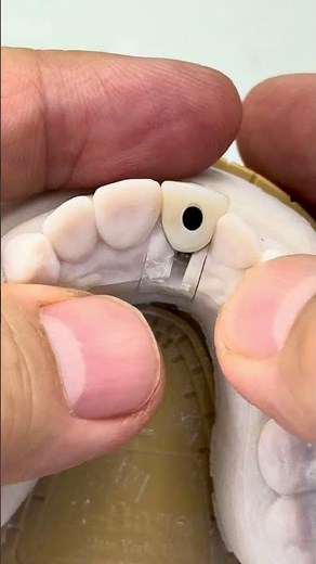 Screw retained implant crown process!
