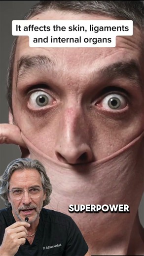 The Real Life Human Rubber Band!