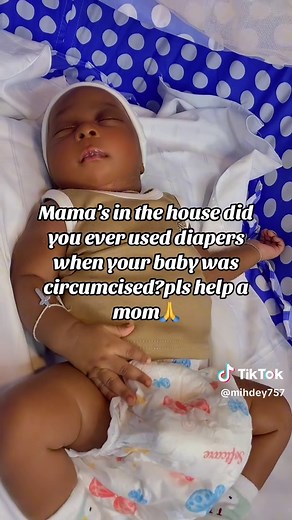 Circumcision and Diaper Use for Newborns: A Guide