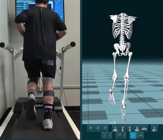 Video vs 3D gait analysis challenges | Kevin Vandi DPT, CSCS posted on the topic | LinkedIn