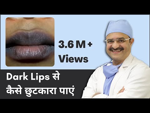 Dark Lips Treatment: How to Get Rid of Dark Lips (Dark Lips से कैसे छुटकारा पाएं) | (In HINDI)